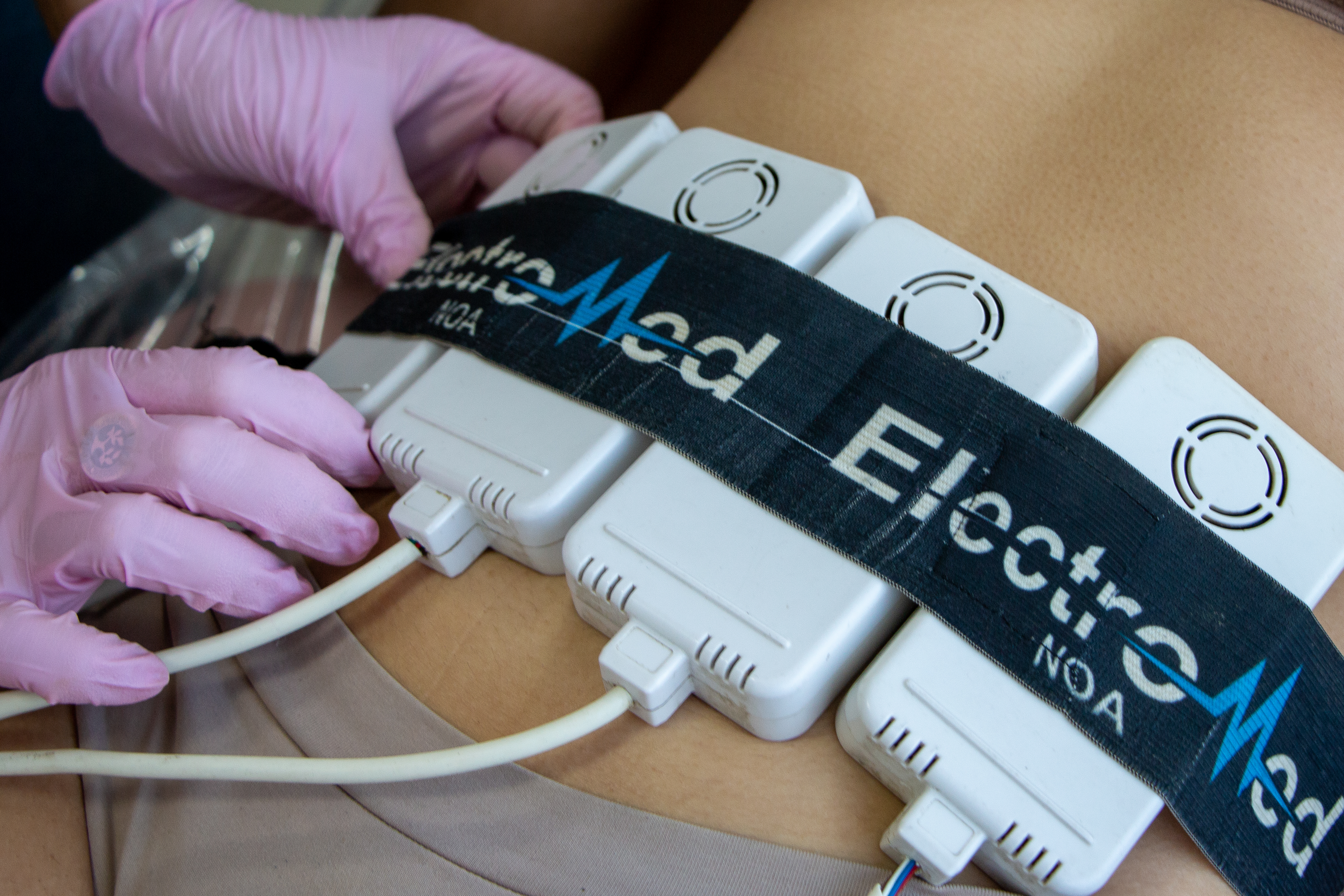 modal criolipólisis imagen